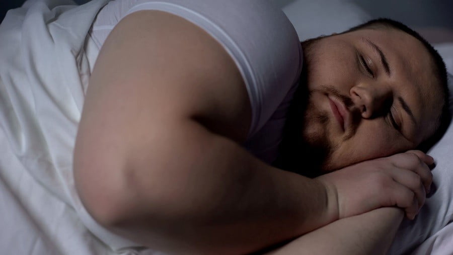 Sleep Apnea and Obesity